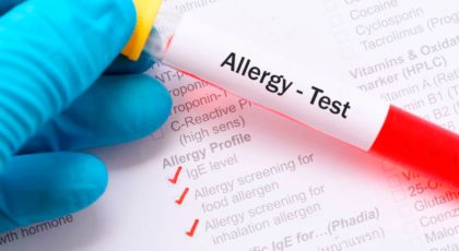 Allergologie | Allergien