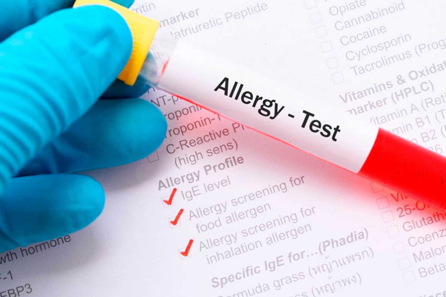 Allergologie | Allergien