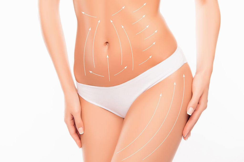 Liposuction | Fettabsaugen
